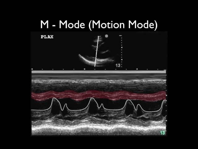 Ultrasound Physics Scanning Modes M Mode