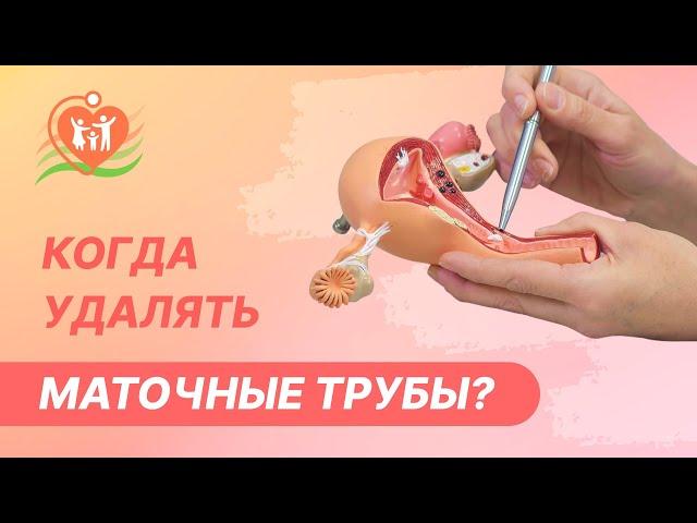 ‍️  Когда удалять маточные трубы?