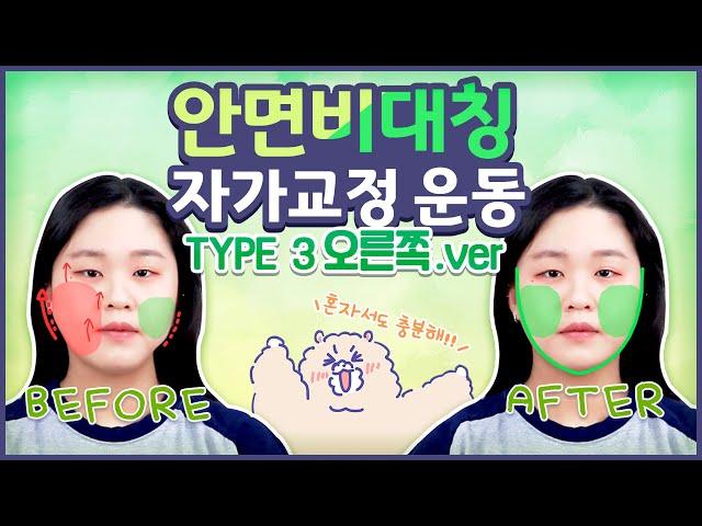 [오른쪽] 안면비대칭 type 3 자가교정운동 | 정파카