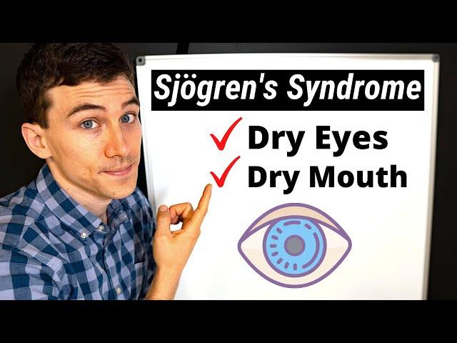 What is Sjögren's Syndrome? Eye Doctor Explains