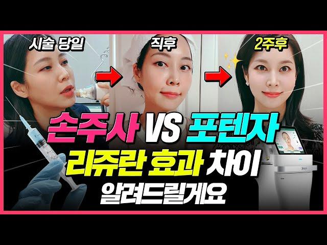 [리쥬란X포텐자] 셀프 시술 후 2주간의 리얼후기 알려드립니다! 리쥬란 시술방법 [손주사 vs 포텐자] 효과 뭐가 더 좋을까?