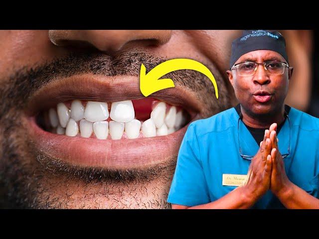 Should I replace my tooth? HOW? (dental implants & alternatives)