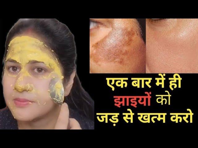 Instant pigmentation remove athome || How to remove pigmentation