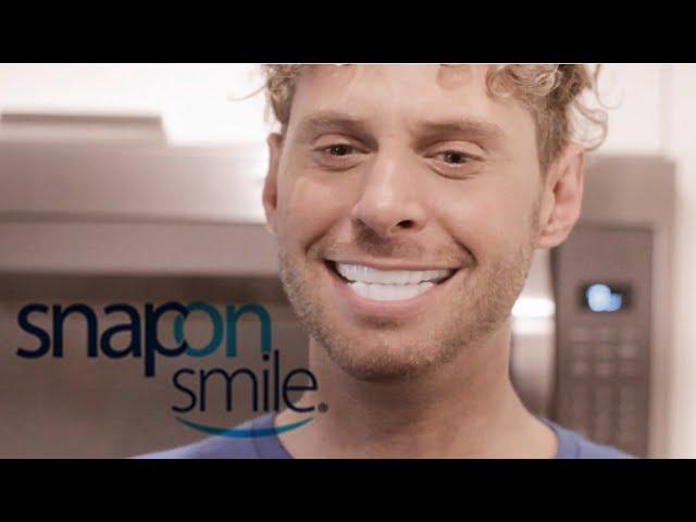 HONEST REVIEW: Snap-On Smile veneers