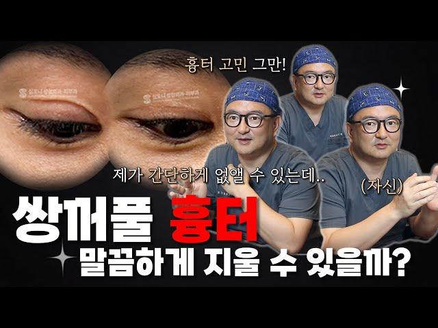 압구정재봉틀의 쌍꺼풀 흉터제거수술로 얼마나 개선될 수 있을까?