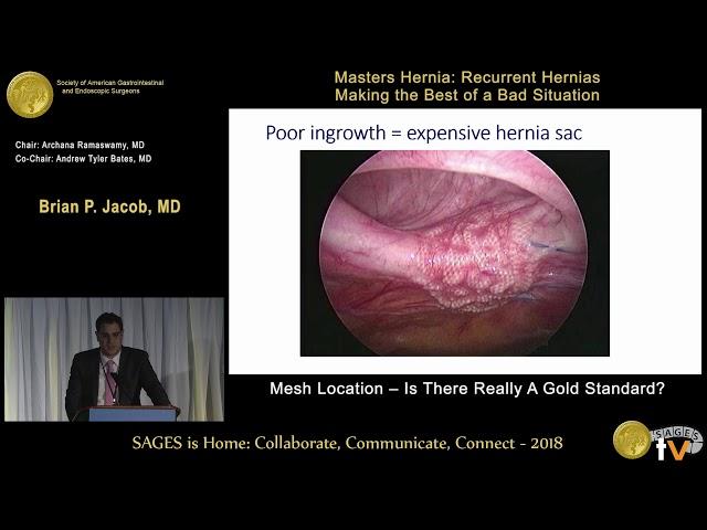 Mesh location - Is there really a gold standard?