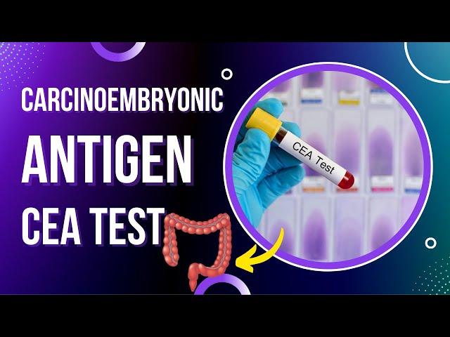 Carcinoembryonic Antigen Test | CEA Blood Test | Tumor Marker