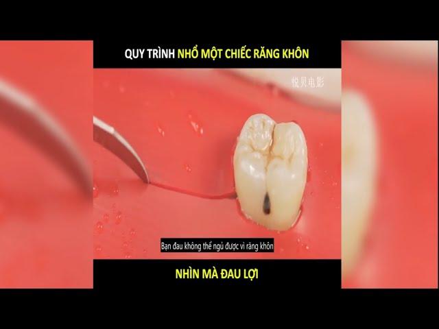 Nhổ một chiếc Răng Khôn đau đến mức nào | LT Review