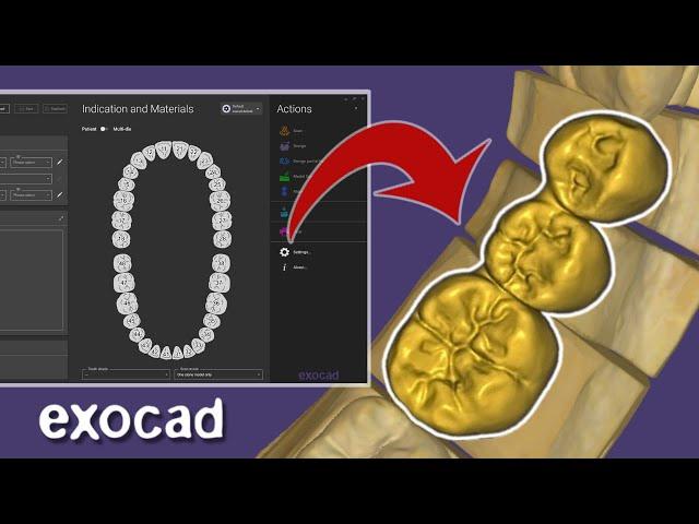 Bridge EXOCAD. 2024 Tutorial