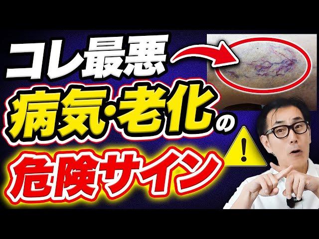 【放置厳禁】絶対に見逃さないで！深刻な病気につながる危険サインと対処法を教えます！【細絡 老化】