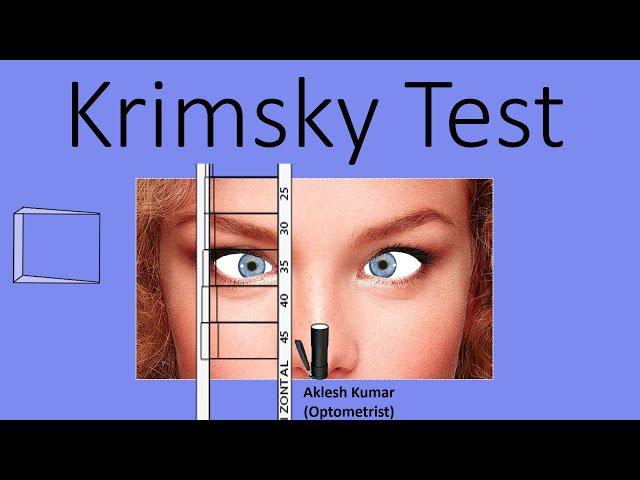 Krimsky Test | Prism Bar Reflex Test | PBRT | Modified Hirschberg test  | corneal reflex test