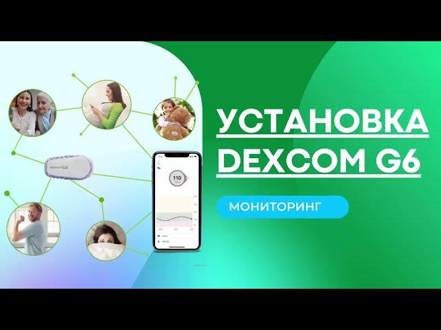 Установка мониторинга Dexcom G6