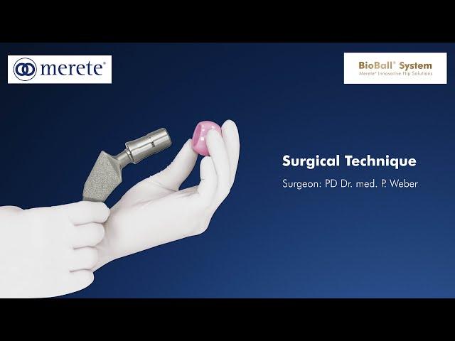 Merete. Surgical Technique. BioBall® Adapter System. PD Dr. med. P. Weber (München)