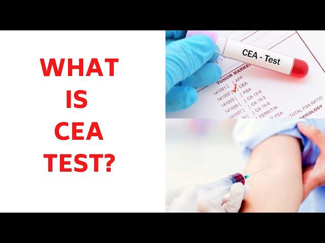 WHAT IS CEA BLOOD TEST?: Carcinoembryonic Antigen Test Levels-  CEA Blood Test Meaning