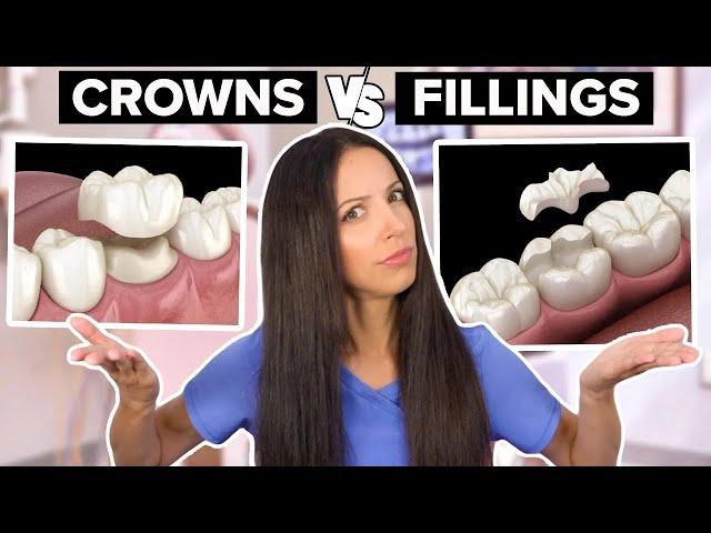 Dental Crowns Vs Dental Fillings (What's the Difference?)