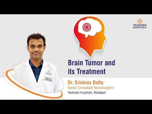 Brain Tumor and its Treatment | Yashoda Hospitals Hyderabad