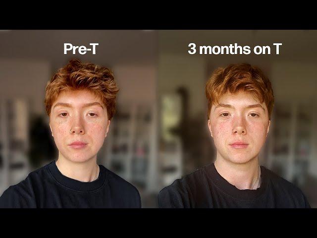 I documented every change my first 3 months on testosterone