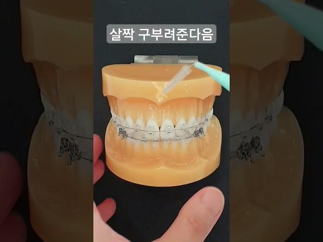 교정환자 치간칫솔 사용법, How to use interdental brush for orthodontic patients #shorts