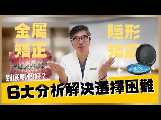 隱適美牙齒矯正是什麼？到底該選金屬矯正還是隱形矯正好？從6大面向分析來解決你的牙齒矯正選擇障礙｜【祐民牙醫－隱適美旗艦店】鑽石級楊大為醫師 #隱適美   #隱形矯正 #隱形牙套 #牙齒矯正 #矯正牙齒