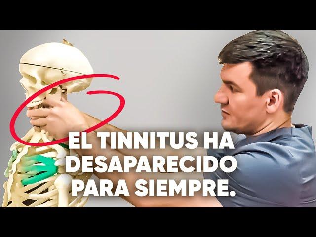 Las 3 principales causas del tinnitus. ¡Hice esto y todo desapareció!