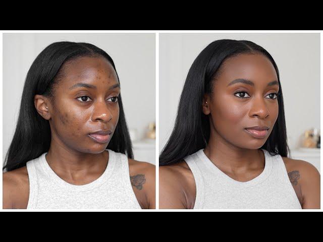 My NO FOUNDATION Summer Makeup Routine | Cover Acne Scars & Hyperpigmentation Without Foundation