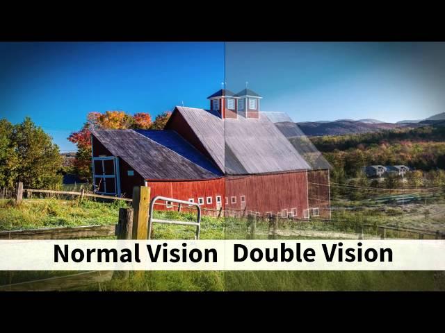 Vision problems in MS