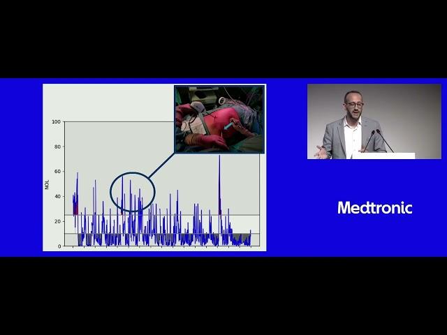 Implementing NOL monitoring in Clinical Practice