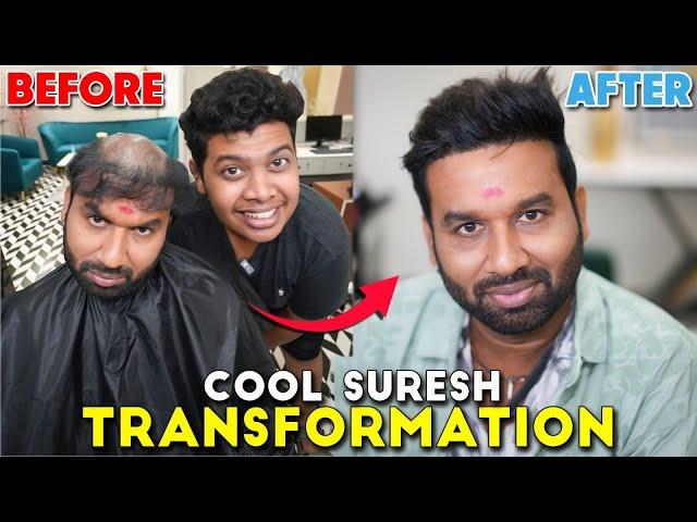 Hair Transformation For Cool Suresh  | DR Hair - Irfan's View