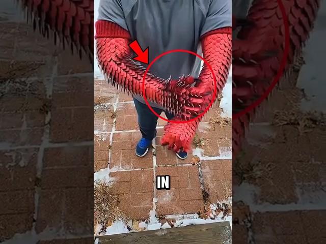 Scales on the Hand? Don’t Wait—RUN‼️️️