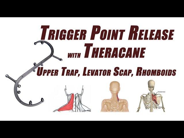 Trigger Point Release in the Upper Trapezius, Levator Scapulae, and Rhomboids Using a Cane Device