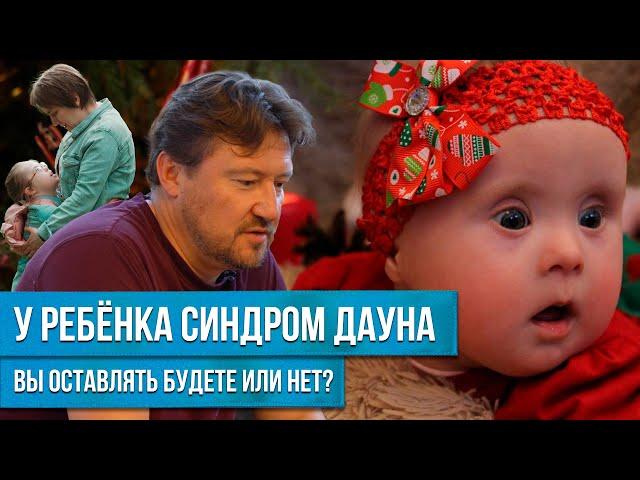 УНИКАЛЬНЫЙ СЛУЧАЙ! РОДИТЕЛИ ИЗ РЕБЕНКА С СИНДРОМОМ ДАУНА ВЫРАСТИЛИ МАЛЕНЬКОГО ГЕНИЯ