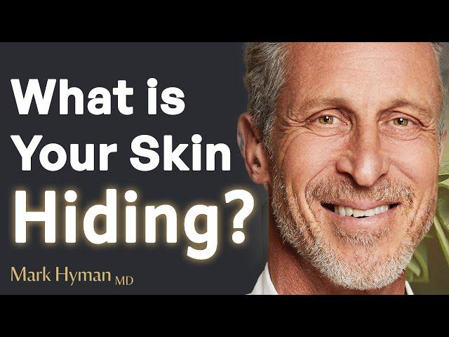 Struggling with Acne or Eczema? You Could Be Ignoring Serious Health Red Flags | Dr. Mark Hyman