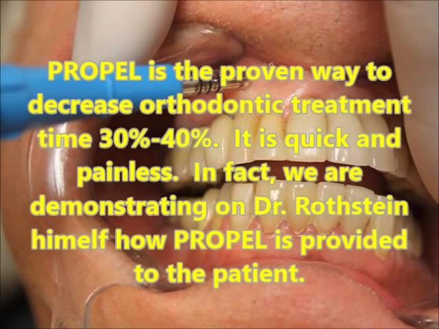 The Propel System in Action