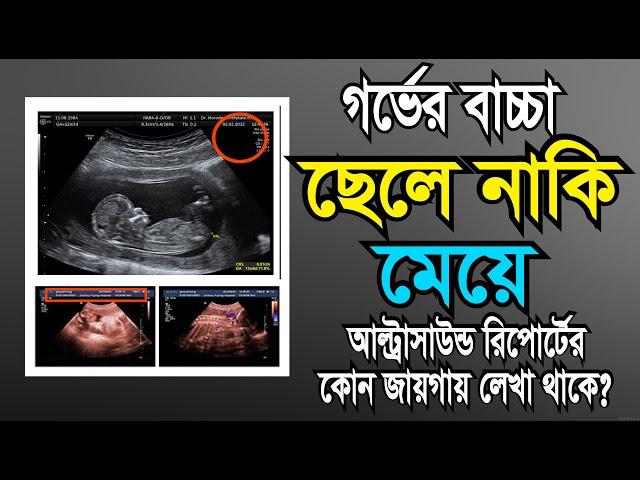 গর্ভের সন্তান ছেলে না মেয়ে আল্ট্রাসনোগ্রাম রিপোর্ট দেখে কিভাবে বুঝবেন? || আল্ট্রাসনোগ্রাফি রিপোর্ট