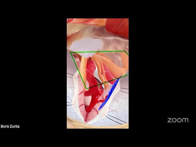 Masterclass sobre Craneofaringioma: Cuando no Operar?