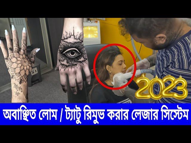 skin brightening laser treatment | bangladesh tattoo remove | tattoo removal laser | saidur tattoo