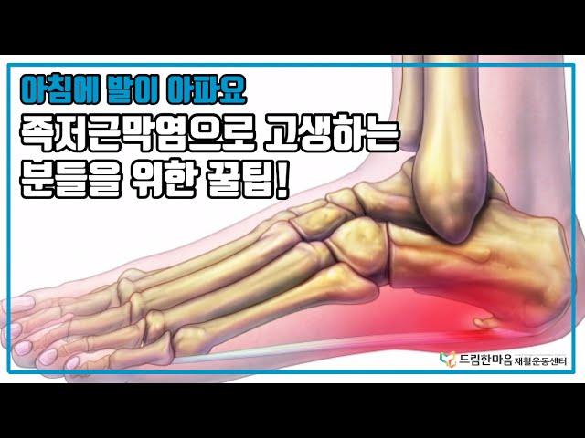 [드림한마음재활운동] 족저근막염 편