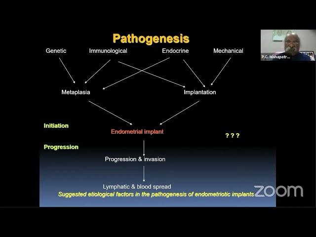 Surgical Procedures in Endometriosis | Techniques, Challenges & Management | 26th Dec 2020 Webinar