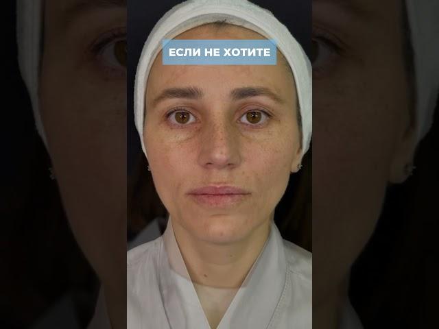 #косметолог #акне #лифтингмосква #москва #фейсбилдинг #уход #botox #уходзажирнойкожей #ботокс