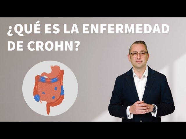 Enfermedad de Crohn: Causas, síntomas y tratamientos | Stanford