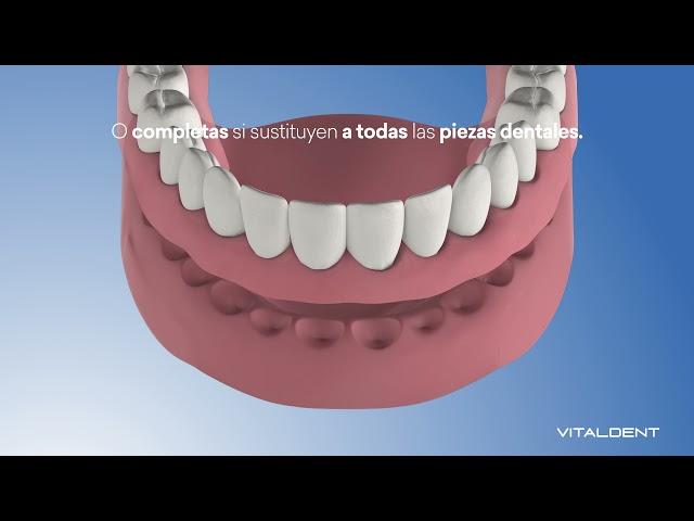 Prótesis Dental Removible - Vitaldent