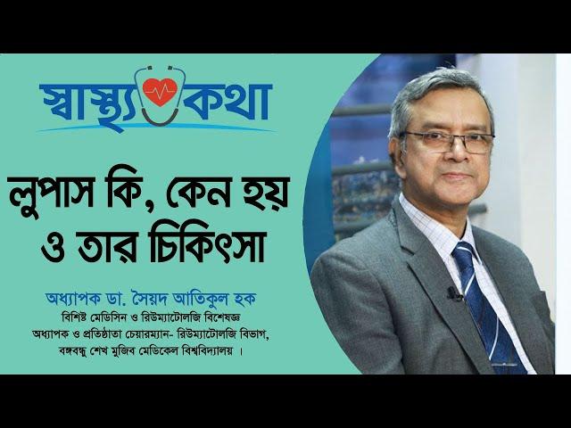 লুপাস কি, কেন হয় ও তার চিকিৎসা