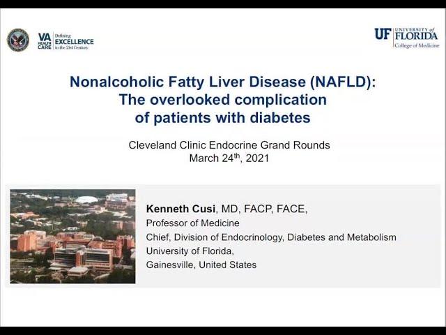 Nonalcoholic Fatty Liver Disease (NAFLD): the Overlooked Complication of Obesity and Type 2 Diabetes