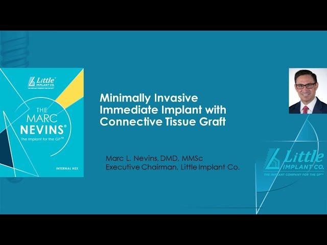 Minimally Invasive Immediate Implant with Connective Tissue Graft