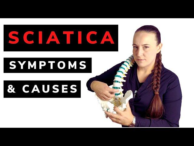 Sciatica causes and symptoms. What is pinching sciatic nerve?