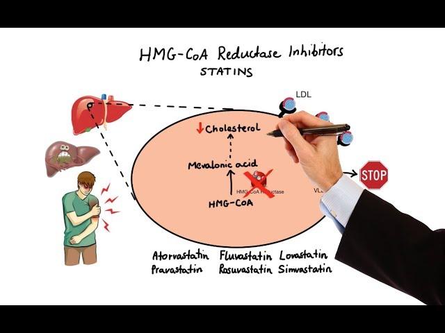 Pharmacology - DRUGS FOR HYPERLIPIDEMIA (MADE EASY)