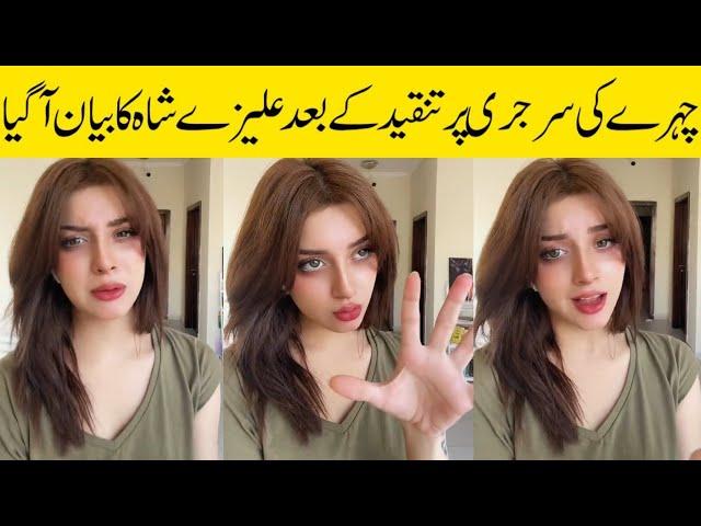 Alizeh Shah's Shutup Call To All Haters After Facial Surgery