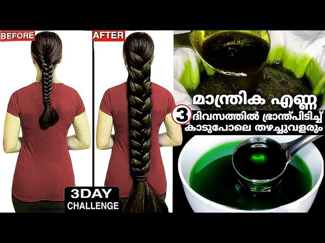 10രൂപയിൽ,3ദിവസത്തിൽ മുടി ഭ്രാന്തുപിടിച്ചു വളരും അത്ഭുതകരമായ എണ്ണ! Hair Growth Oil