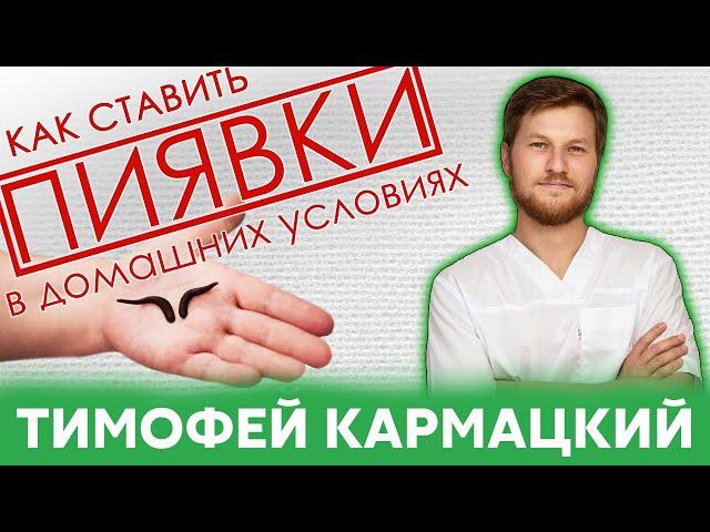 ПИЯВКИ. КАК СТАВИТЬ в домашних условиях? Тимофей Кармацкий