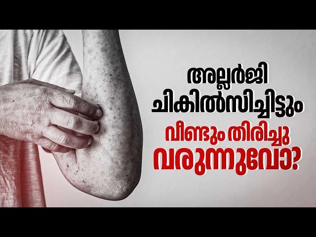 മാനസികാരോഗ്യം അല്ലർജിയെ ബാധിക്കുമോ?| Allergy | Recurring Allergy Causes | Allergy Treatment | Health